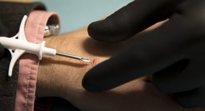 В США создали криптовалютный кошелёк, встраиваемый под кожу